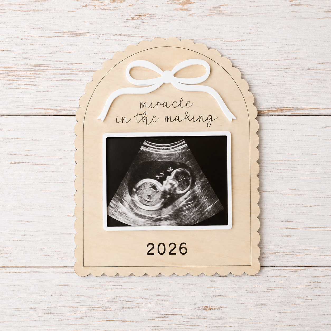 MemoryForU Treasured Pregnancy Announcement Custom Photo Frame